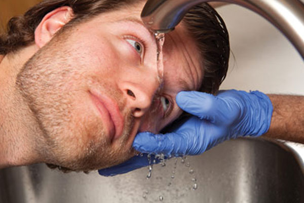 Первая помощь при ожоге глаз