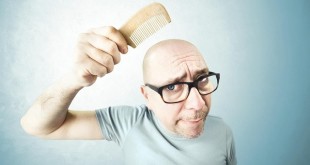Облысение у мужчин - причины и лечение